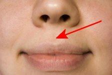 no-lip-wrinkles.jpg no-lip-wrinkles.jpg