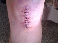 knee.jpg