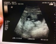 baby ultrasound.jpg