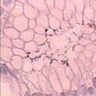 H.Pylori