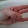 Stankie Finger