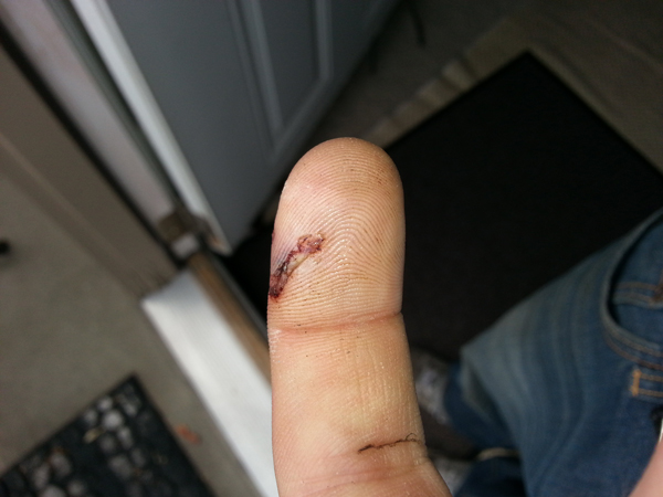 i almost cut off my finger with a hand saw :(