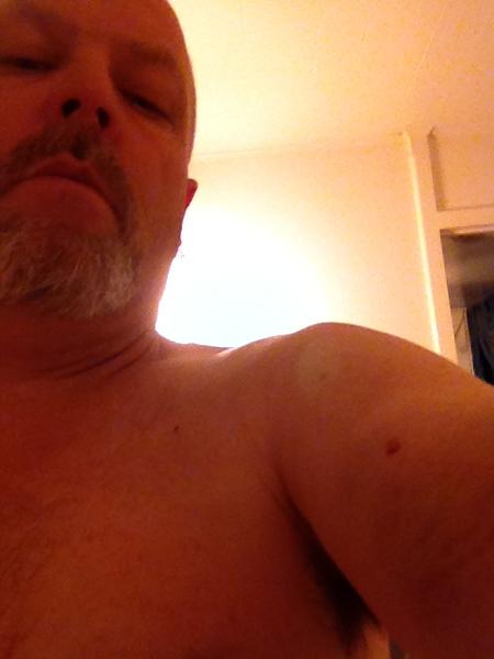 Small nick on my arm, but it hurts like hell. Must have been a large chunk that hit here. Hurts more then rest combined...