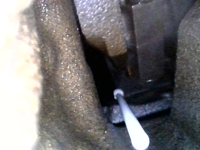 endoscope2.jpg